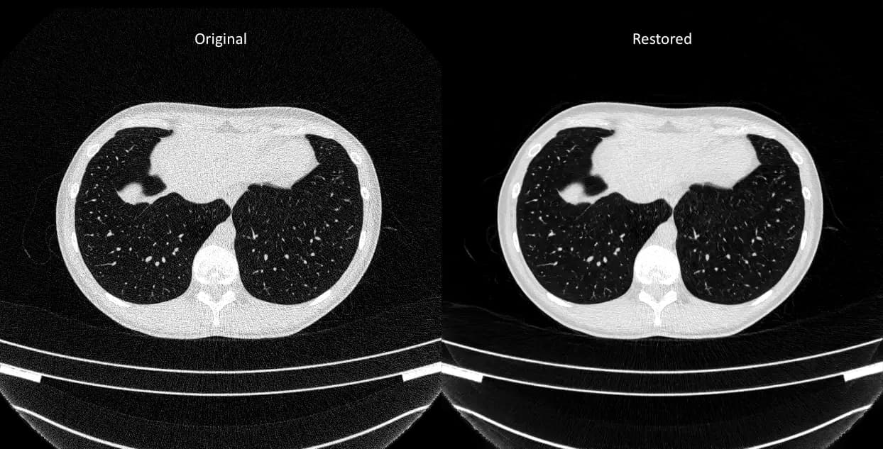 CT Scan Super-Resolution & Denoising
